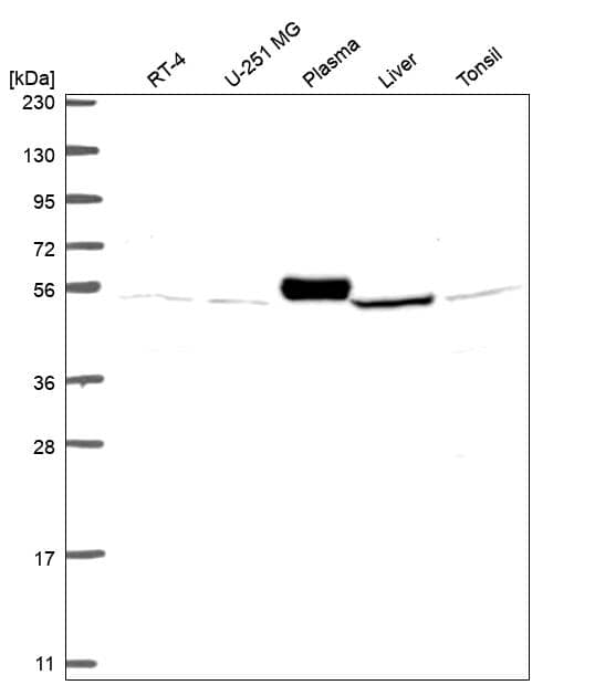 Analysis in human cell line RT-4, human cell line U-251 MG, human plasma, human liver tissue and human tonsil tissue.