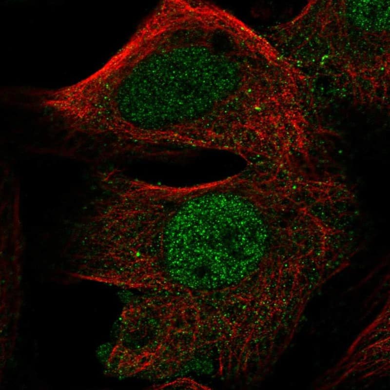 Immunocytochemistry/ Immunofluorescence FOXD4L1 Antibody