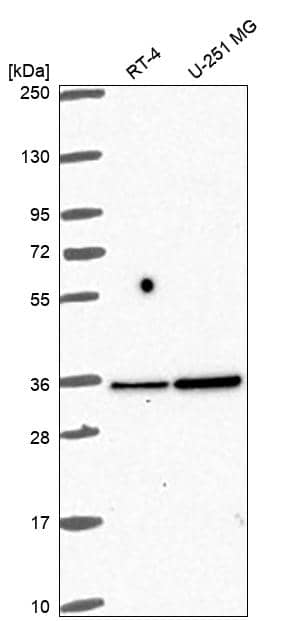 Analysis in human cell line RT-4 and human cell line U-251 MG.