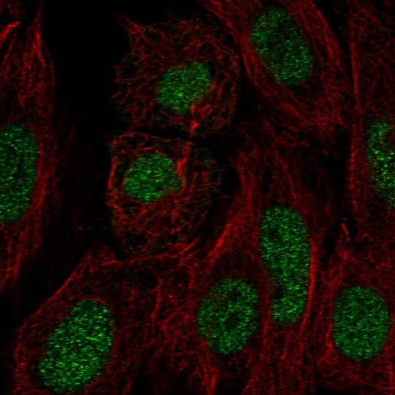 Staining of human cell line SiHa shows localization to nucleoplasm.