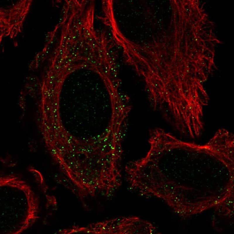 Staining of human cell line PC-3 shows localization to vesicles.