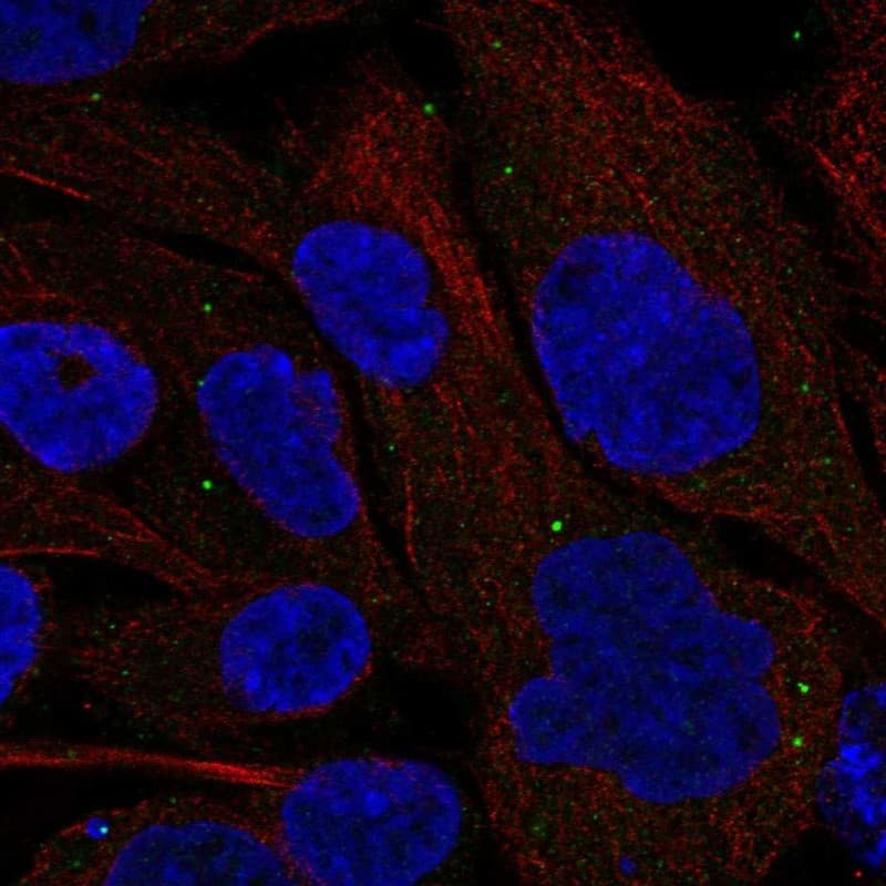 Staining of human cell line A-431 shows localization to vesicles.