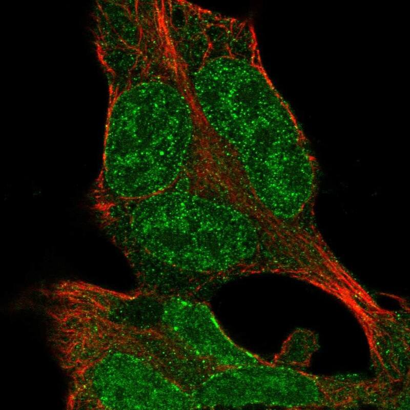 Immunocytochemistry/ Immunofluorescence ZNF398 Antibody - BSA Free
