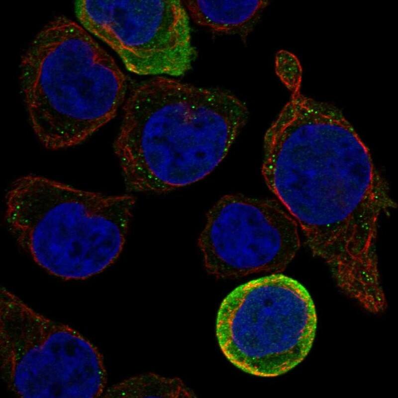Staining of human cell line HEL shows localization to plasma membrane & vesicles.
