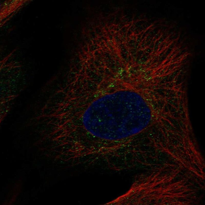 Staining of human cell line hTERT-RPE1 shows localization to the Golgi apparatus.
