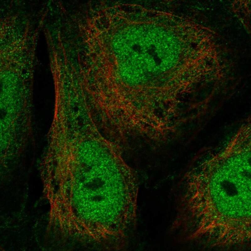 Staining of human cell line SuSa shows localization to nucleoplasm & cytosol.