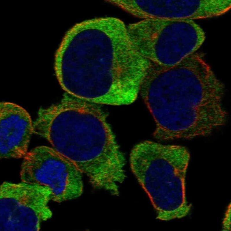 Staining of human cell line HEL shows localization to cytosol.