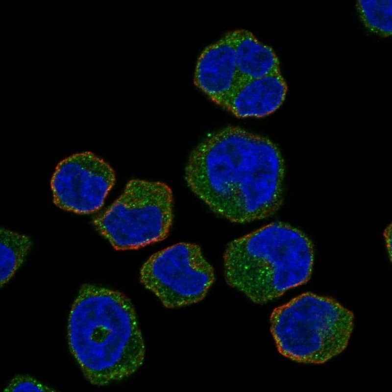 Staining of human cell line HEL shows localization to cytosol & vesicles.