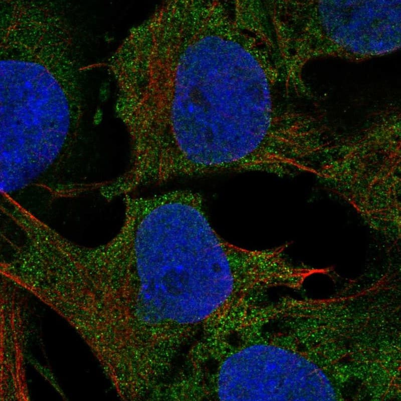 Staining of human cell line SuSa shows localization to cytosol.