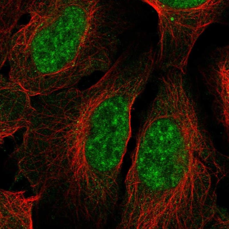 Immunocytochemistry/ Immunofluorescence HspB9 Antibody