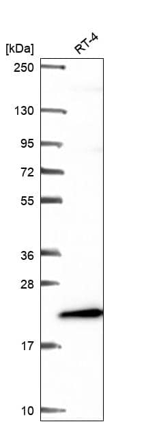 Analysis in human cell line RT-4.