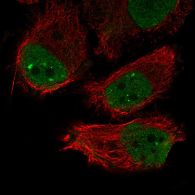 Staining of human cell line PC-3 shows localization to nucleoplasm & nuclear bodies.