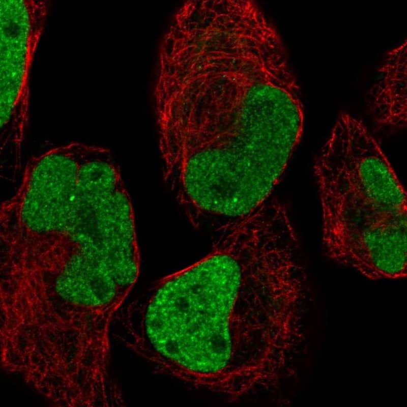 Staining of human cell line Rh30 shows localization to nucleoplasm.