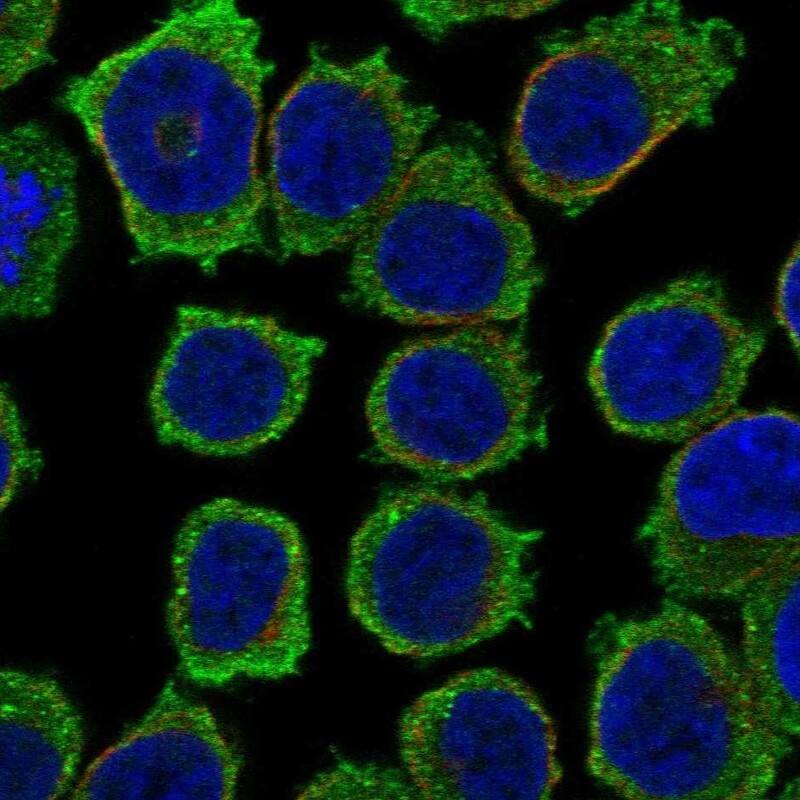 Staining of human cell line HEL shows localization to cytosol.