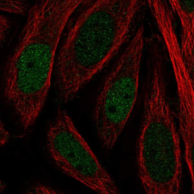 Staining of human cell line SiHa shows localization to nucleoplasm.