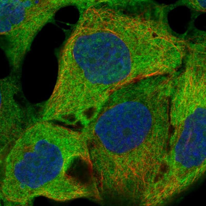 Staining of human cell line EFO-21 shows localization to nuclear speckles, plasma membrane & cytosol.