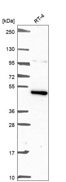 Analysis in human cell line RT-4.