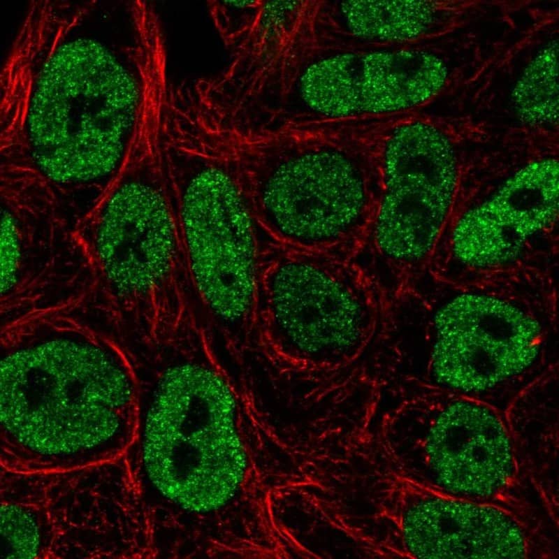 Staining of human cell line RT-4 shows localization to nucleoplasm.