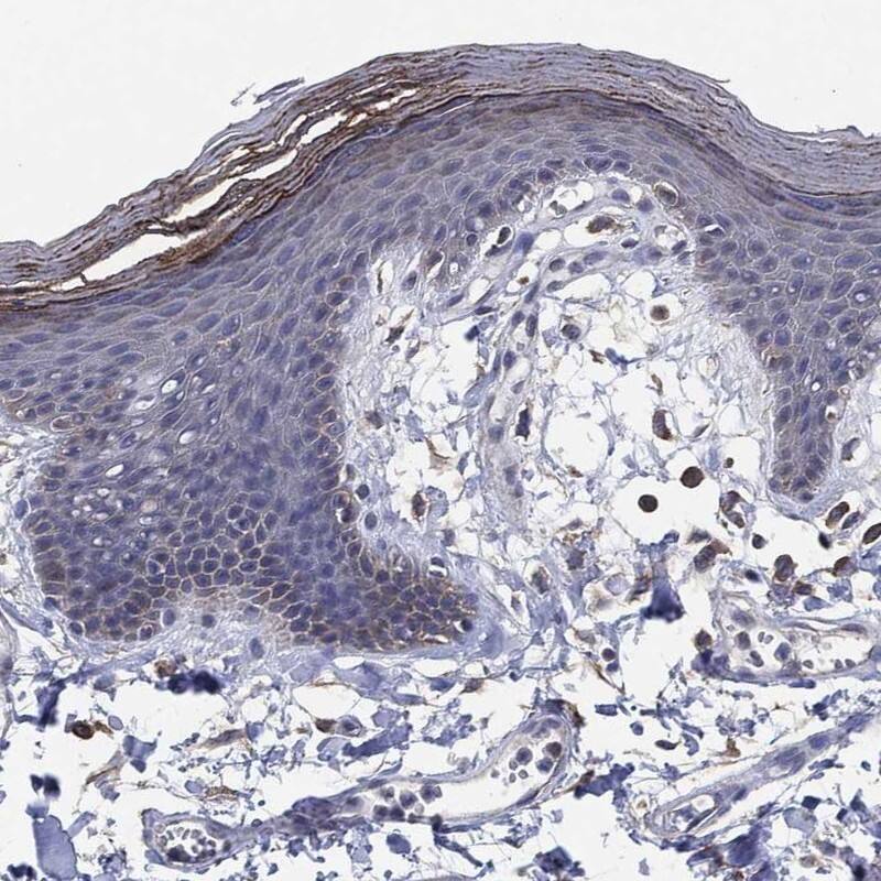 Staining of human skin shows cytoplasmic positivity in epidermal cells.