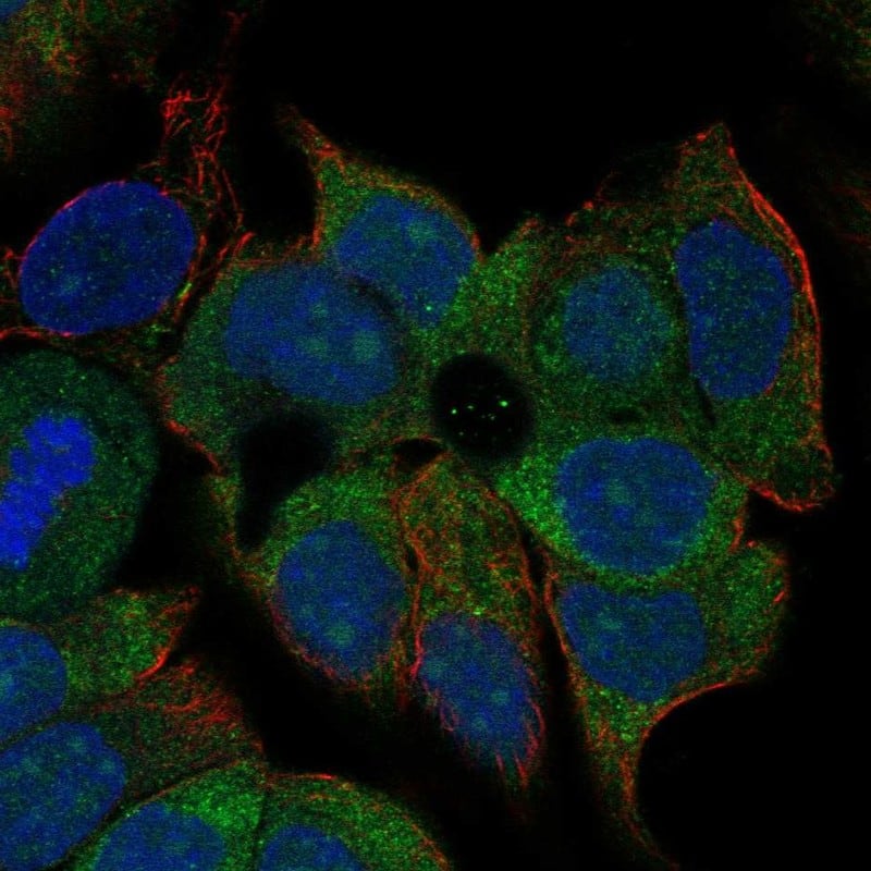 Staining of human cell line OE19 shows localization to plasma membrane & cytosol.