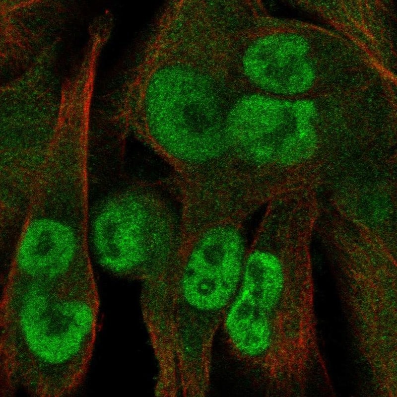 Staining of human cell line SK-MEL-30 shows localization to nucleoplasm.