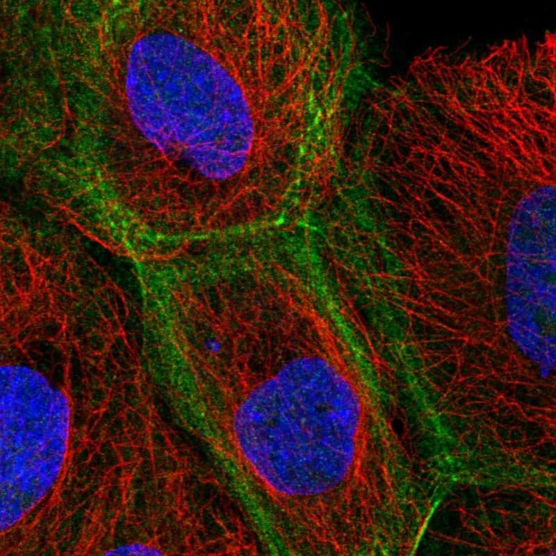 Immunocytochemistry/ Immunofluorescence KIF3B Antibody