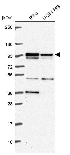 Analysis in human cell line RT-4 and human cell line U-251 MG.