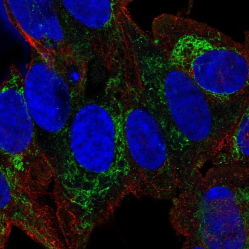 Staining of human cell line SH-SY5Y shows localization to mitochondria.