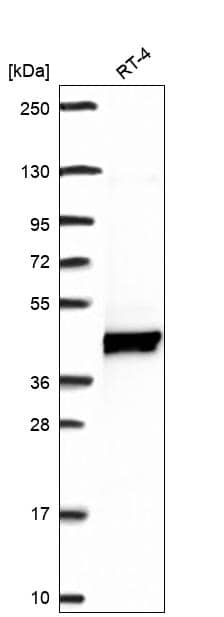 Analysis in human cell line RT-4.