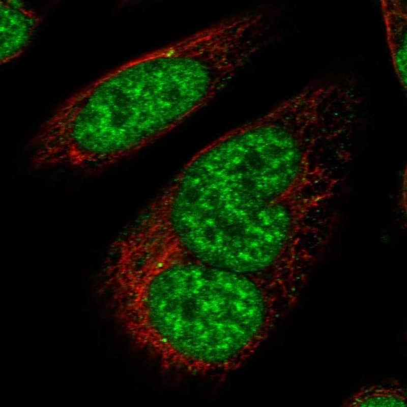 Staining of human cell line SiHa shows localization to nucleoplasm & nuclear speckles.