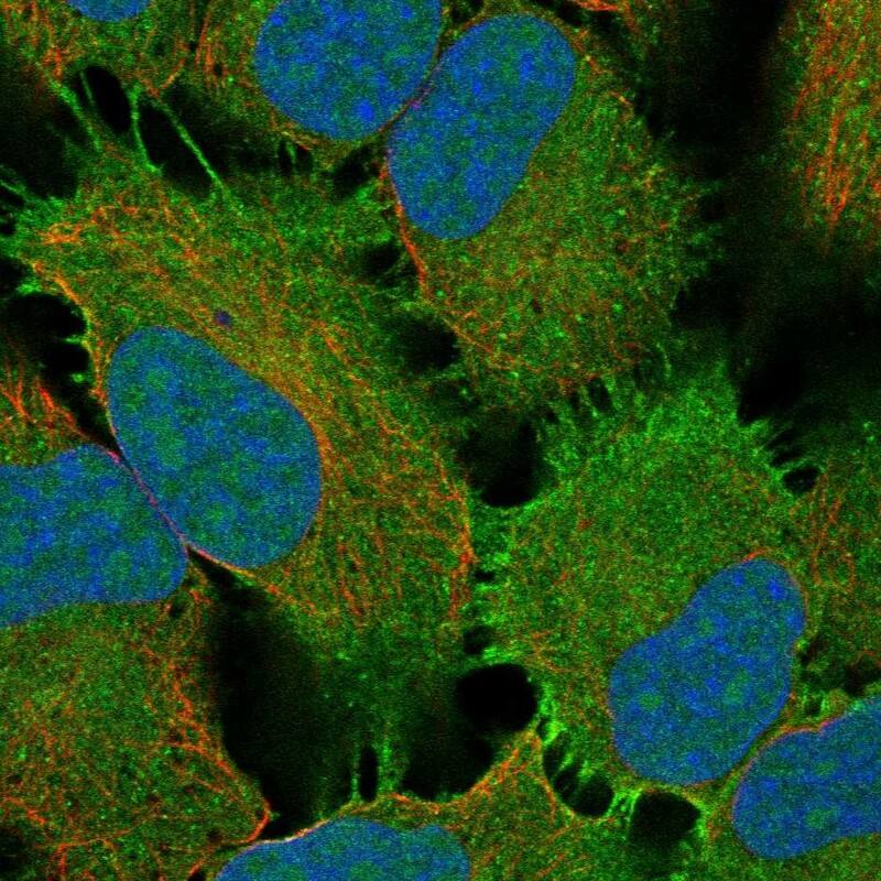 Staining of human cell line HeLa shows localization to plasma membrane.