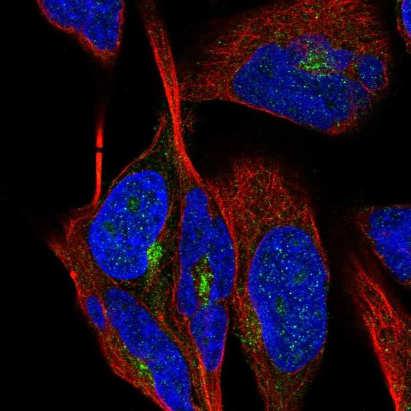 Immunocytochemistry/ Immunofluorescence Lebercilin Antibody