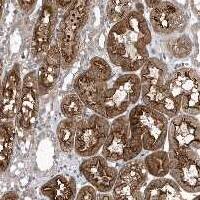 Staining of human kidney shows strong membranous and cytoplasmic positivity in tubular cells.