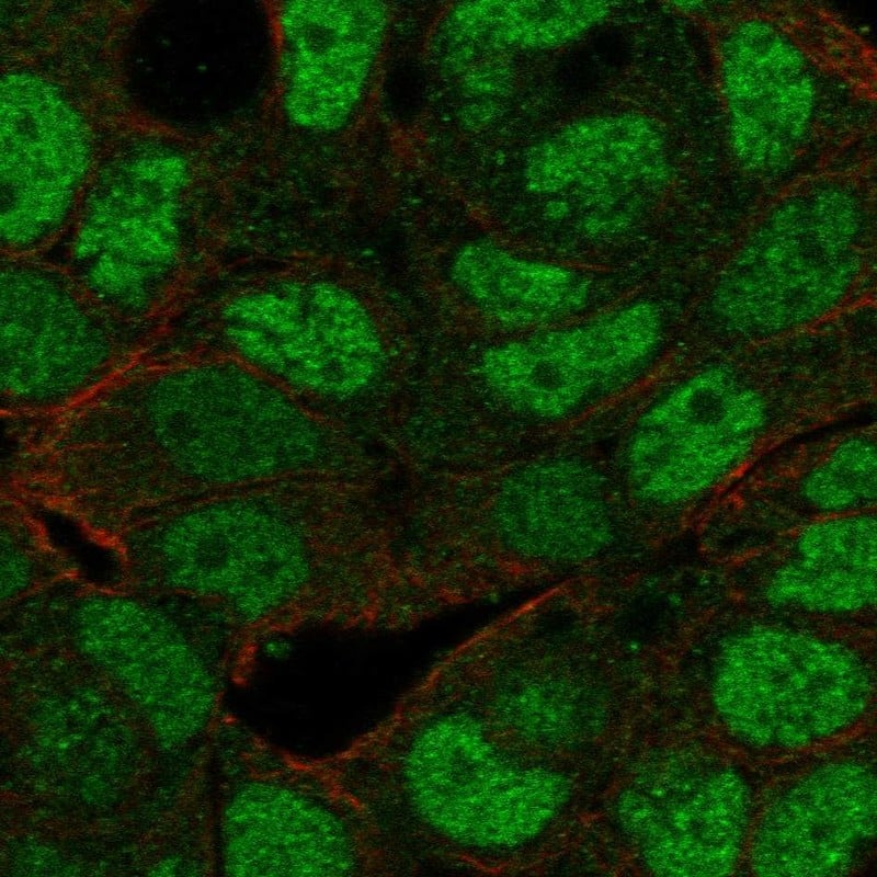 Staining of human cell line OE19 shows localization to nucleoplasm & cytosol.