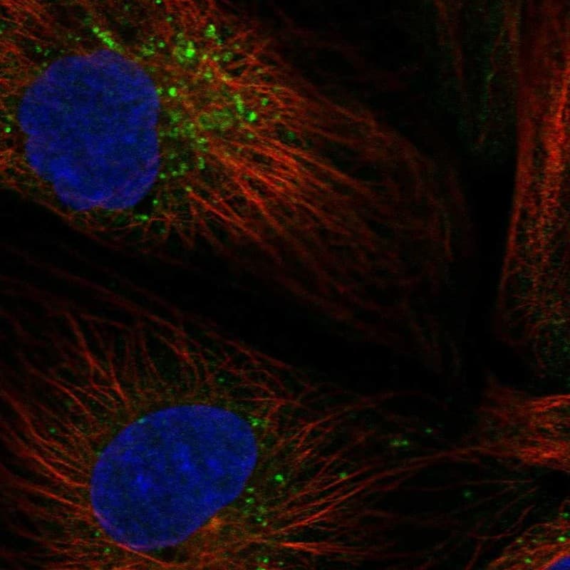 Staining of human cell line SuSa shows localization to vesicles.