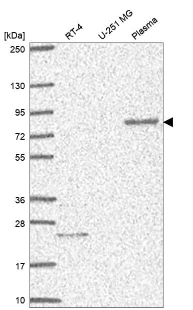 Analysis in human cell line RT-4, human cell line U-251 MG and human plasma.