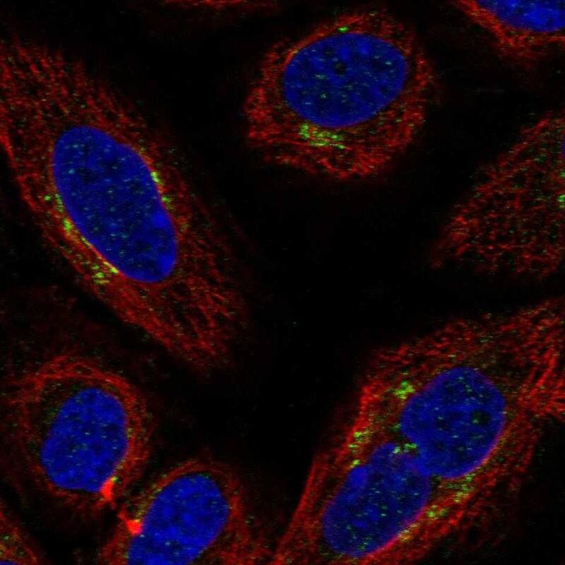 Staining of human cell line SiHa shows localization to the Golgi apparatus & vesicles.