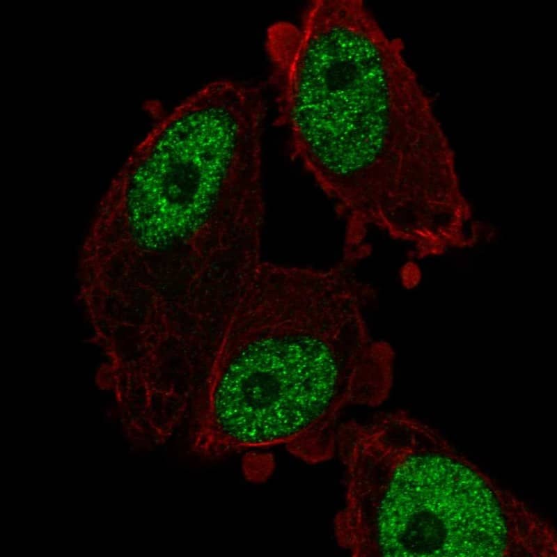 Immunocytochemistry/ Immunofluorescence MED26 Antibody