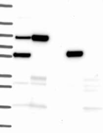 Lane 1: Marker [kDa] 250,130,95,72,55,36,28,17,10Lane 2: RT-4Lane 3: U-251MGLane 4: Human PlasmaLane 5: LiverLane 6: Tonsil