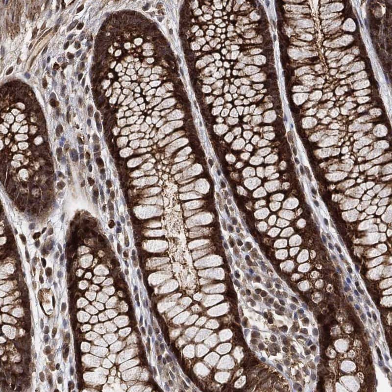 Staining of human colon shows cytoplasmic positivity in glandular cells.