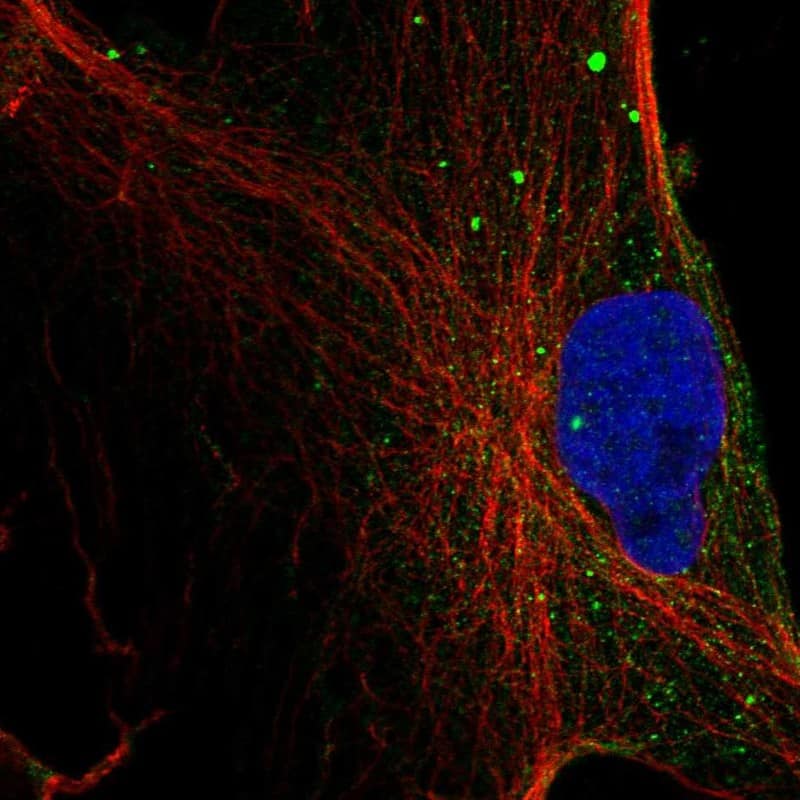 Staining of human cell line BJ [Human fibroblast] shows localization to vesicles.