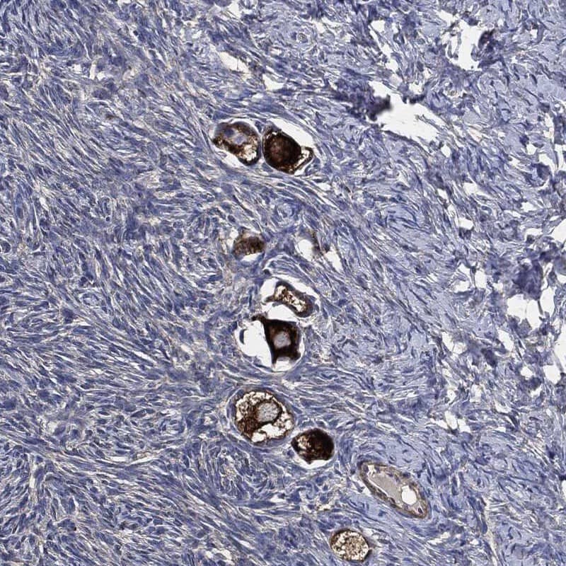 Staining of human ovary shows cytoplasmic positivity in follicle cells.