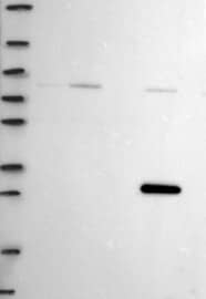 Lane 1: Marker [kDa] 250,130,95,72,55,36,28,17,10Lane 2: RT-4Lane 3: U-251MGLane 4: Human PlasmaLane 5: LiverLane 6: Tonsil