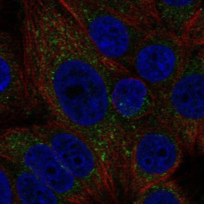 Staining of human cell line MCF-7 shows localization to vesicles.