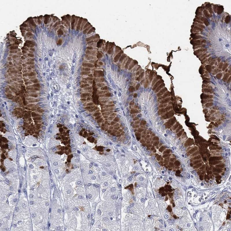 Staining of human stomach shows strong positivity was observed in subset of glandular cells.