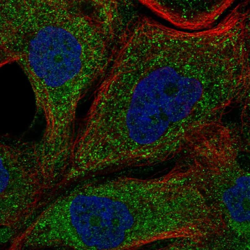 Staining of human cell line EFO-21 shows localization to cytosol.