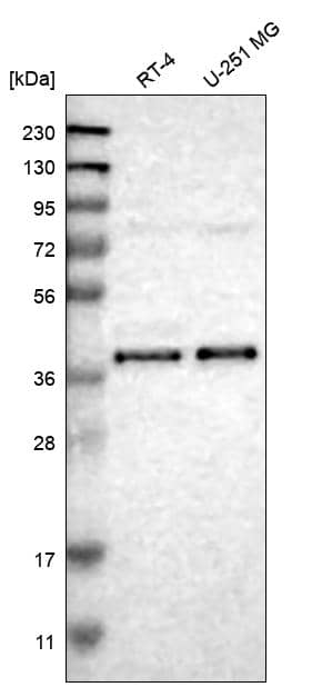 Analysis in human cell line RT-4 and human cell line U-251 MG.