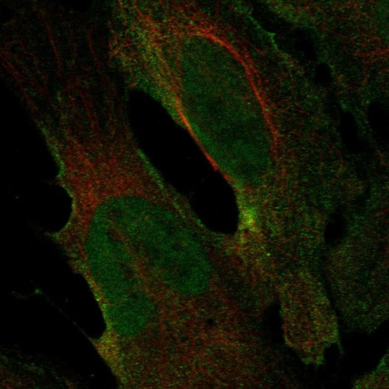 Immunocytochemistry/ Immunofluorescence Nicotinic Acetylcholine R alpha 2/CHRNA2 Antibody - BSA Free