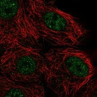 Immunocytochemistry/ Immunofluorescence NUDT17 Antibody - BSA Free