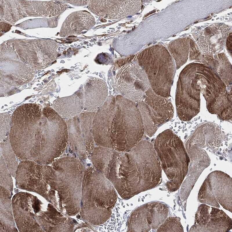Staining of human skeletal muscle shows moderate cytoplasmic positivity in myocytes.